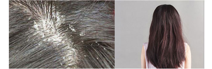 ���ϼ���-ɽ�����{������