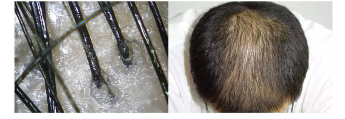 ���ϼ���-ɽ�����{������